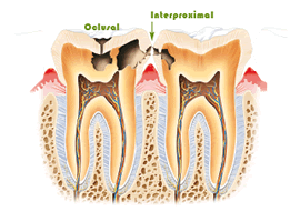 dolor dental